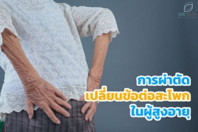 การผ่าตัดเปลี่ยนข้อต่อสะโพกในผู้สูงอายุ